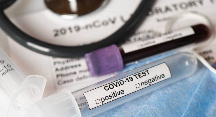 Test na obecność koronawirusa